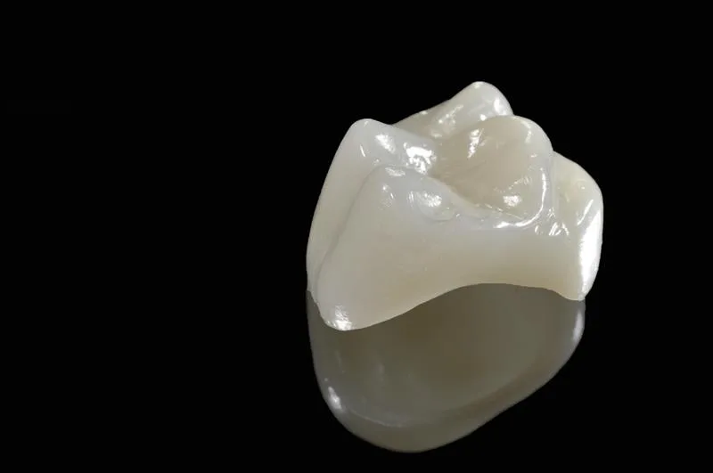 Porcelain Crowns at Flossed Family Dentistry in San Tan Valley, AZ